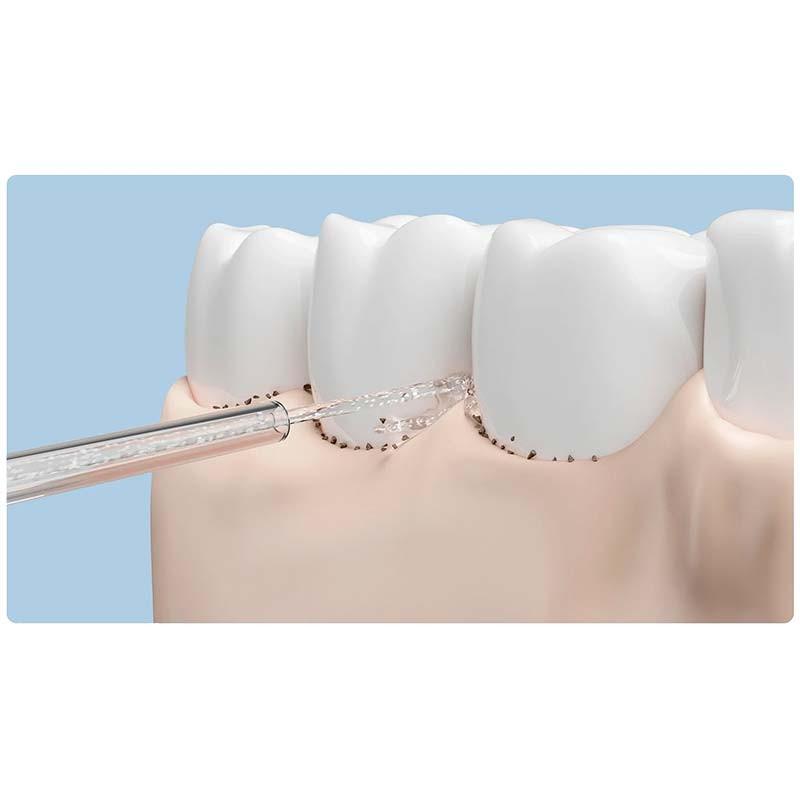 Xiaomi Water Flosser Replacement Tips - jet d'eau ciblé